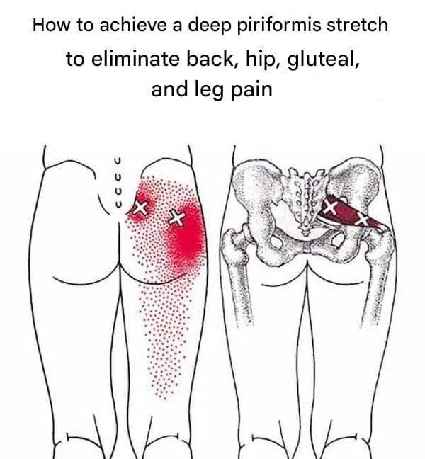 How to achieve a deep piriformis stretch to eliminate back, hip, gluteal, and leg pain