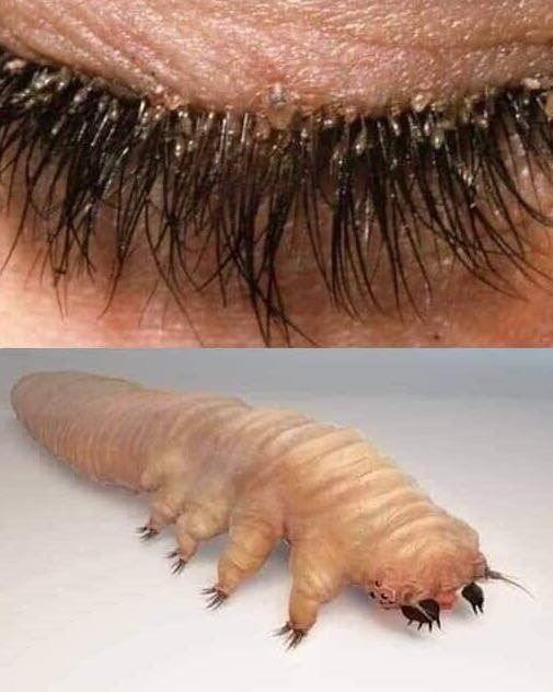 How To Spot Eyelash Mites